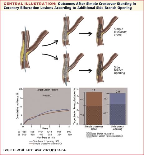 Year Outcome Of Simple Crossover Stenting In Coronary Bifurcation