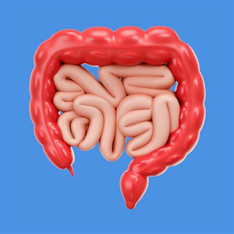 Sindrome De Ogilvie 2