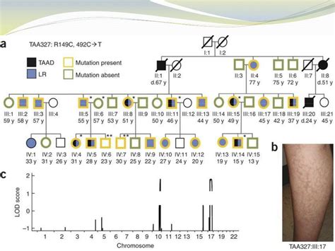 Ppt The Role Of Genetic Testing In Aortic Aneurysm Disease Powerpoint