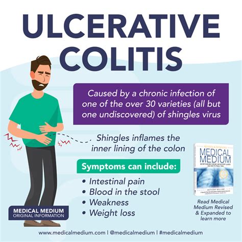 Ulcerative Colitis