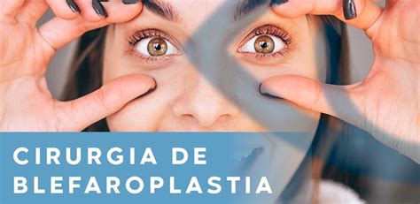 Cirurgia De Blefaroplastia Dra Denise Leite Ribeirão Preto