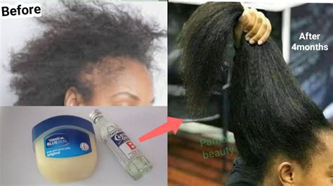 How To Use Vaseline And Castor Oil To Grow Hair 2 Cm Per Day Very Fast