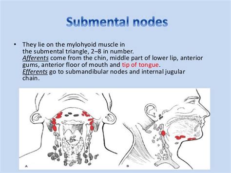 Shotty lymph nodes neck - applepoliz