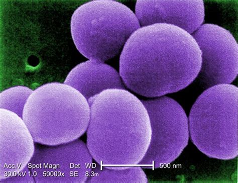 Staphylococcus Aureus Howmed