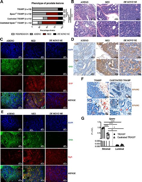 Figure 1 From Castration Induced Downregulation Of SPARC In Stromal