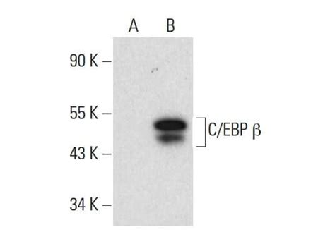 Cebp Beta Antibody A 7 Scbt Santa Cruz Biotechnology