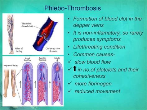 Abdominal surgery | PPT