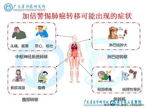 第9期讲座视频：肺癌免疫治疗（含讲座ppt）