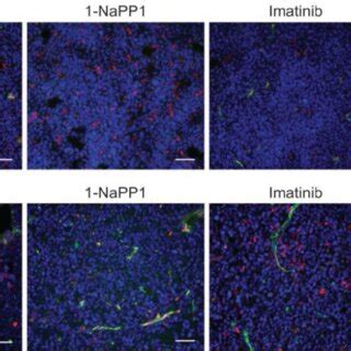 Selective Inhibition Of Pdgfr Impairs Vascular Function And Increases