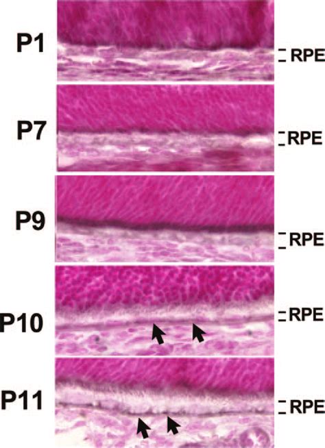 Localization Of Bestrophin In The Rpe During Mouse Postnatal