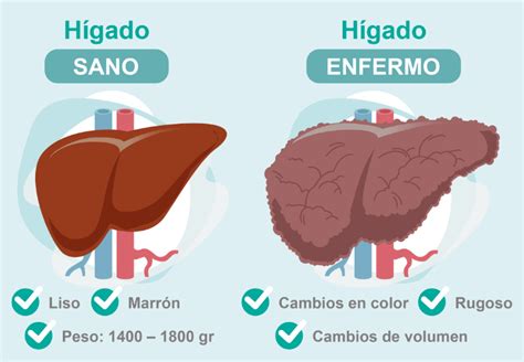 Funciones Del H Gado Roche Pacientes