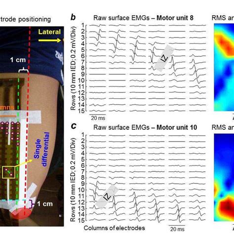 Pdf Surface Emg And Muscle Fatigue Multi Channel Approaches To The