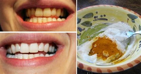 Creative Ideas - How To Whiten Your Teeth Using Turmeric - i Creative Ideas