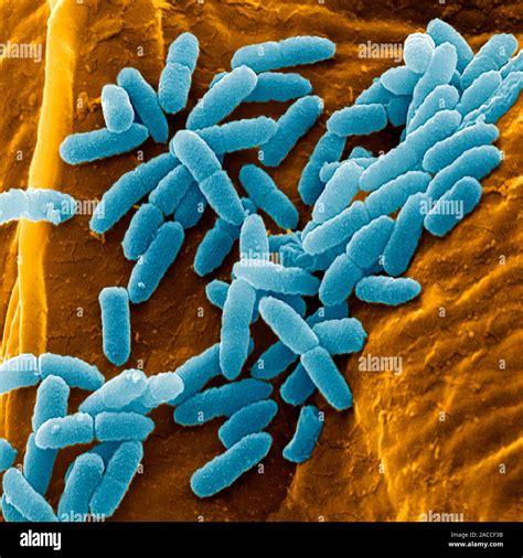 La bacteria Pseudomonas aeruginosa color Micrografía análisis de