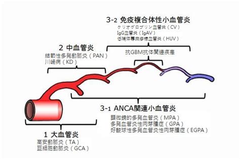 血管炎症候群の分類｜大阪大学大学院医学系研究科 呼吸器・免疫内科学