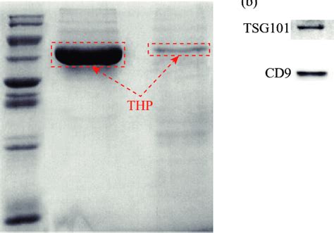 Coomassie Brilliant Blue Staining Sds Page Of Urinary Proteins And