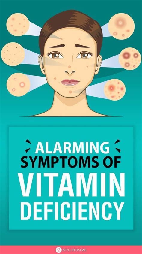 Vitamin D Side Effects Vitamin D Deficiency Symptoms Vitamin B12