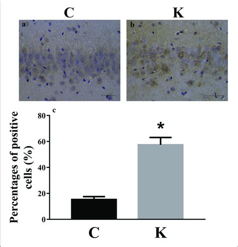 Immunohistochemistry Staining Of Hippocampal Ca Cells In C And K