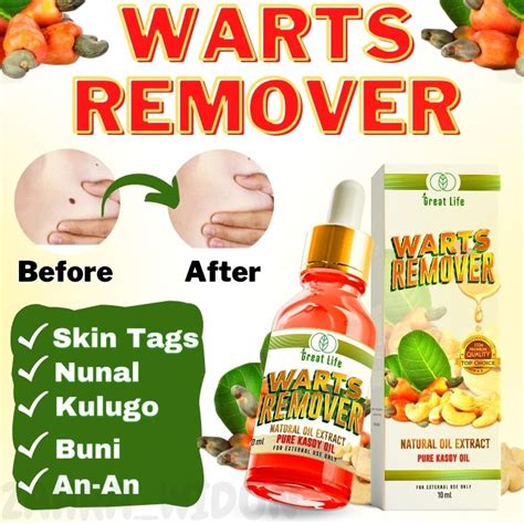 Authentic Warts Remover Original Mole Remover Effective Skin Tags And