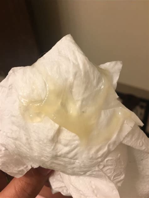 What Does Your Mucus Plug Look Like Possible Tmi Babycenter Hot Sex