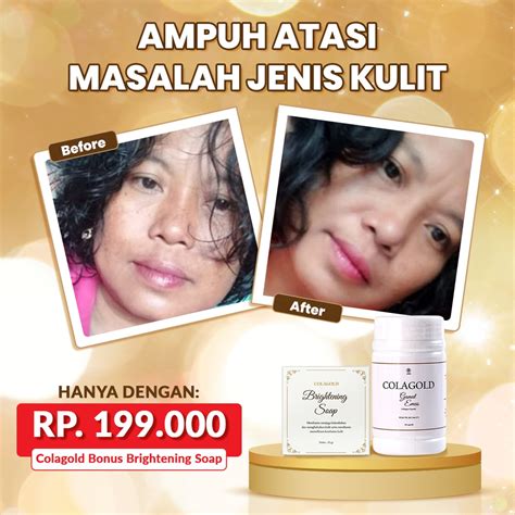 Jual COLAGOLD Collagen Capsule Anti Aging Capsule Penghilang Flek Hitam