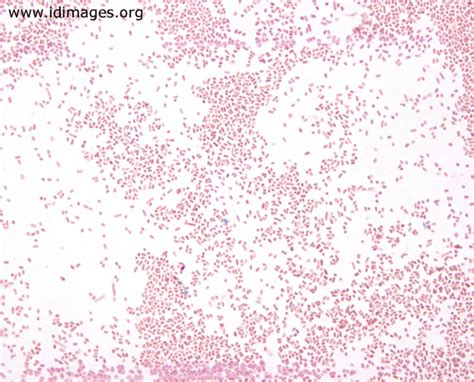 Infectious Disease Images Emicrobes Digital Library Images