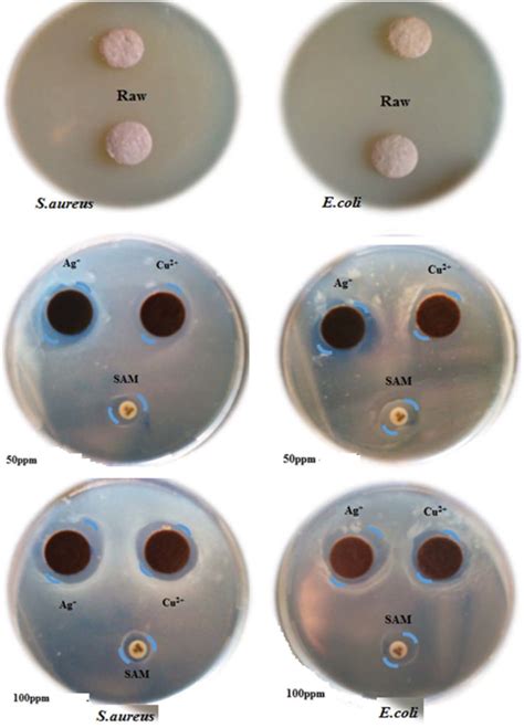 Comparison Of Inhibition Zones For S Aureus Atcc And E Coli