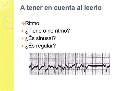 Electrocardiografía Basica Para Enfermería Ppt