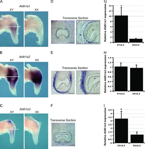 Aldh Expression In The Developing Mouse Prostate A C Whole Mount