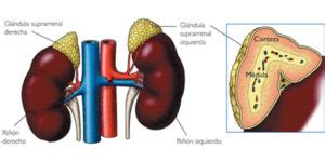 Qu Es La Hiperplasia Suprarrenal Cong Nita Vilamed Vilamed