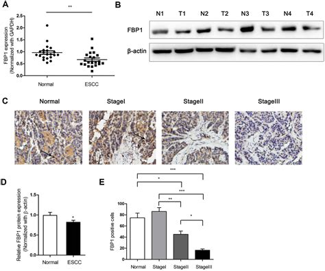 Loss Of Fbp Promotes Proliferation Migration And Invasion By