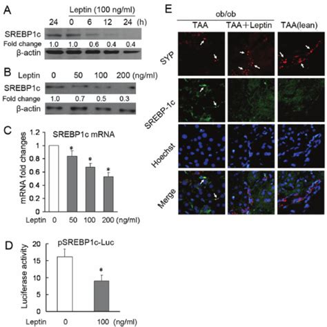 Leptin Reduces Srebp C Gene Expression In Hscs In Vitro And In Vivo