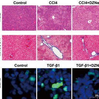 Dznep Resisted Ccl Induced Liver Fibrosis In Rats The Rat Model Was