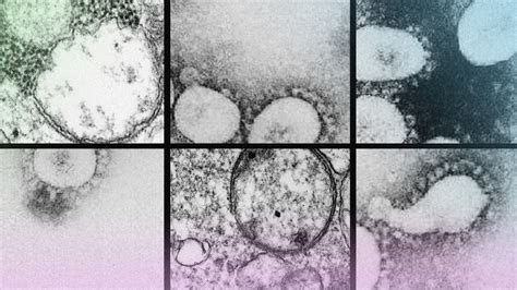 The Coronavirus Brazil Variant Shows The World S Vulnerability The