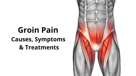 Groin Pain – Causes, Symptoms, and Treatments – National Testicular ...