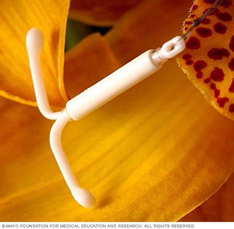 Mirena (hormonal IUD) - Drugs.com