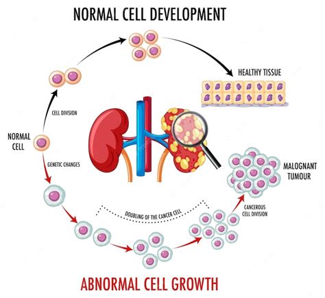 Diagramme Montrant Une Cellule Normale Et Une Cellule Cancéreuse Vecteur Gratuite