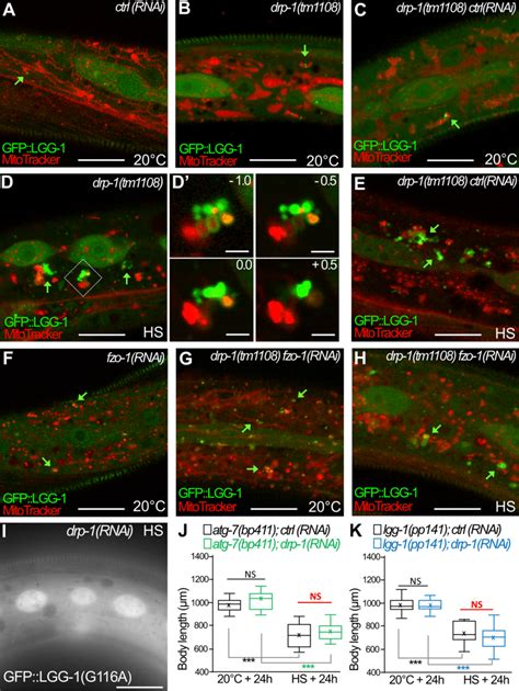 The Clustering Of Autophagosomes At Mitochondria Is Maintained In