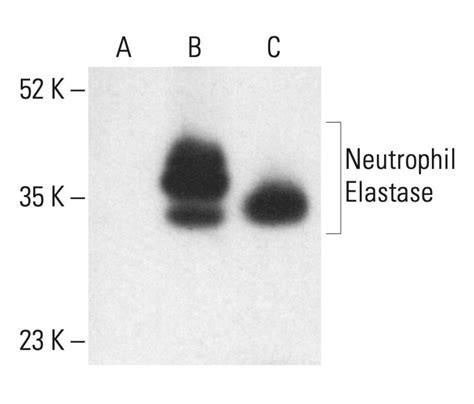 Neutrophil Elastase D Scbt Santa Cruz Biotechnology