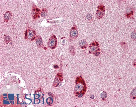 Ihc Plus™ Mineralocorticoid Receptor Monoclonal Antibody Mouse Lsbio