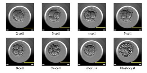 Cell Cleavage Stages Of Human Embryo Development Scale Bar 100 µm Download Scientific Diagram