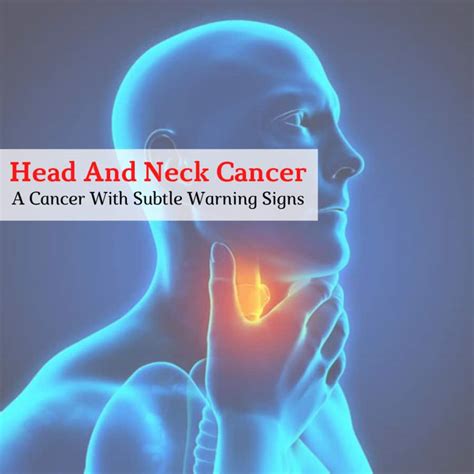 Throat Cancer Early Stages