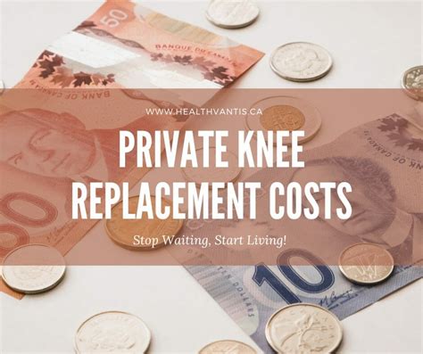 Private Knee Replacement Surgery Cost · Health Vantis