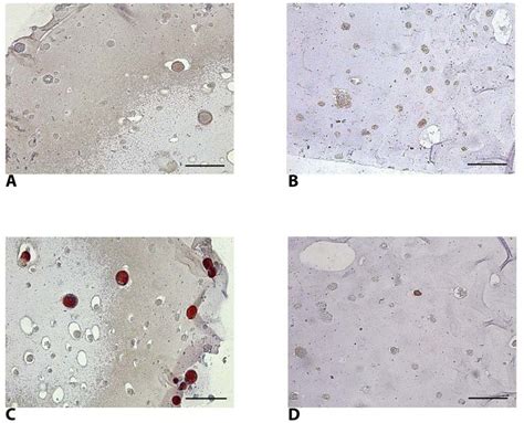 Immunohistochemical Demonstration Of Collagen Type Ii Expression By Download Scientific Diagram