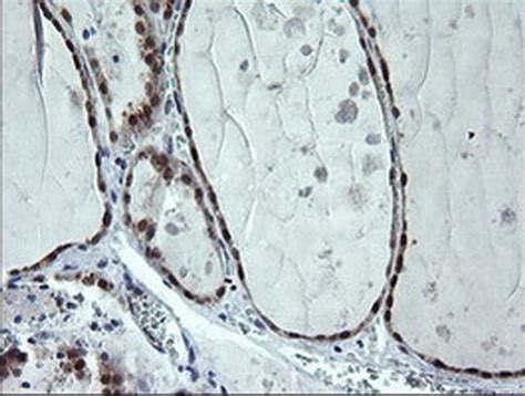 Cmpk Monoclonal Antibody Oti A Invitrogen L Unconjugated