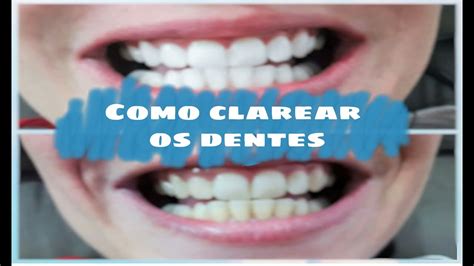 Como Clarear Os Dentes Em Casa Em Minutos Youtube