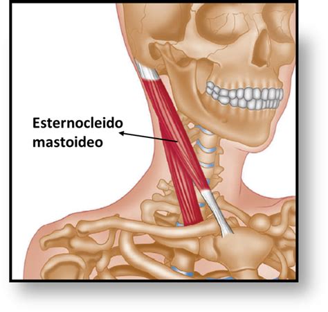 MUSCULO ESTERNOCLEIDOMASTOIDEO Músculo esternocleidomastoideo