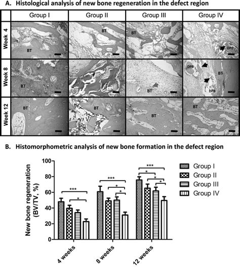 Histological And Histomorphometric Analysis Of New Bone Regeneration