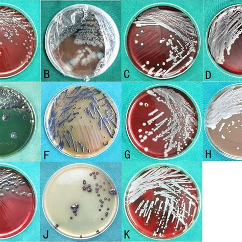 Bacterial culture in the EG. A–K present the types of bacteria in the ...