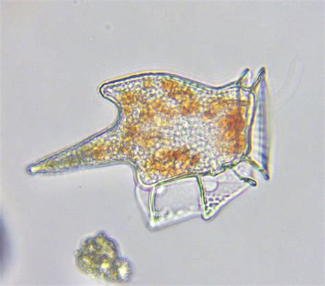 El Universo Bajo El Microscopio Dinophysis